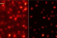 Advanced Electron Microscopy Shows Tiny Metal Nanoparticles Inside Heart Tissue