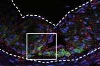 Nanopore Sequencing Technology can Improve Quality and Accuracy of Biological Data