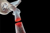 Cell Membrane-Coated Nanoparticles Deliver Drugs Directly to Inflamed Lungs