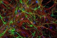 New Nanotechnology Could Help Generate Healthy Electricity in the Human Body