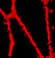 Nanoparticles and Magnetism Used to Drive Cells to Targeted Sites in Blood Vessels