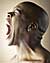 Nanotechnology Tackles Balding as Nanomedicine Prototype Promotes Hair Growth