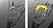 Nanotechnology Reduces Cancer Drug Dose, Increases Effect on Tumors