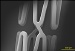 The Development of Next-Generation Drug-Eluting Coronary Stents