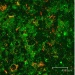 Quantum Rods to Ferry Diagnostic and Therapeutic Agents Across Blood-Brain Barrier