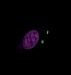 Study Answers Key Questions About Role of Particle Shape and Size in Nanomedicine