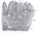 Drug Delivery Particles Breaking the Mucus Barrier
