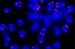 Researchers are Hoping for Improved Therapies for Treating Age-Related Diseases