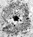 Biomarker Could Give People Advance Warning of Disease