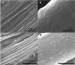Electronic Textiles Capable of Detecting Diseases and Monitoring Heart Rates