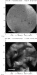 Improving the Nanometers-Thick Layer of Polymer Used to Coat Cardiac Stents
