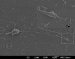 Magnetic Nanotubes to Treat Neurodegenerative Disorders
