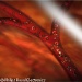 Tiny Particles that can Deliver Drugs Directly to Disease Sites