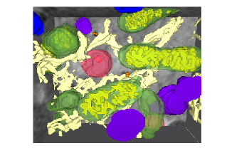Active Ingredients-Coated Nanoparticles Could Destroy Cancer Cells