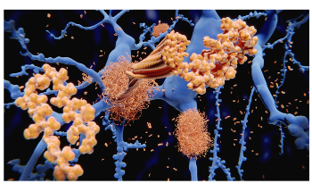 Gold Nanoparticles Used for Imaging and Profiling Amyloid Morphological Polymorphism
