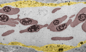 Zebrafish Embryo Model Helps Understand the Workings of Nanoparticles in Blood