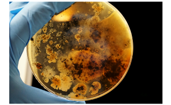 DNA Nanotechnology Could Help Combat Antibiotics-Resistant Bacteria