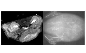 Size Matters: Bimodal Imaging Receives Nanoparticle Enhancement