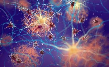 How Nanotechnology can Enable Testing for Early Alzheimer’s Disease