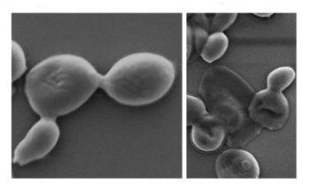 New Superbug-Destroying Coating Could Prevent and Treat Deadly Infections