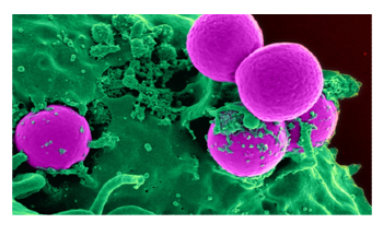 Combination of Nanoparticles and Bioglass can Help Fight Harmful Bacteria