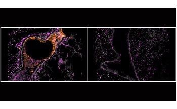 Inhalable Nanobodies can Treat Severe COVID-19 Infection