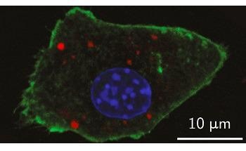 New Nanoparticle Contrast Agents Could Help Better Identify Tumors