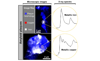 Study Reveals Presence of Nanoscale Metallic Particles in the Human Brain