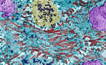 Poly-Ion Complex Nanomicelles Effectively Deliver Inhibitors to Modulate Lipid Metabolism in Brain Cells