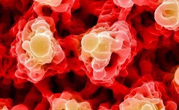 Cancer Cells Extend Nanoscale Tentacles to Disarm Cellular Attackers
