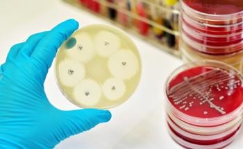 Nanoparticles Help Enable Autonomous Pathogen Biosensor For Food Diagnostics