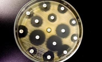 Antibacterial Properties of Silver, Zinc and Graphene Nanomaterials