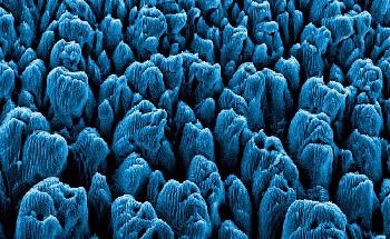 Targeted Nanomedicine Treatment Shows Promise in Reducing Vascular Lesions