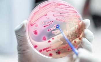 Antimicrobial Plant Cell Culture Supported by Nanocellulose Composite