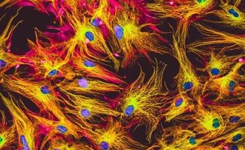 Graphene Could Control Cell Motility and Physiology in Actin Filaments