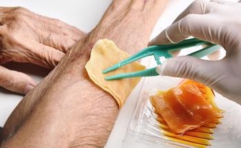 Self-Bonded Hydrogel Forms Basis of Flexible Wound Patch