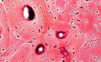 New Combination Enhances Bone Tissue Engineering Biomaterial