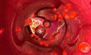 Keeping Track of Circulating Cancer Cells through Nanoparticle Chip