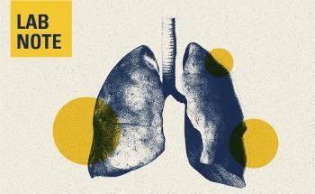 PLG Nanoparticles Inhibit Skin and Lung Fibrosis by Targeting MARCO+ Cells