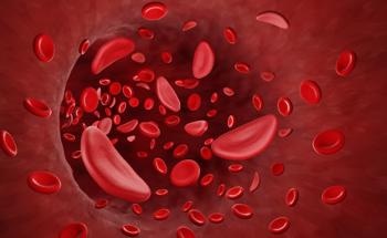 Nanoremover Eliminates Toxin from Hemodialysis Blood Samples