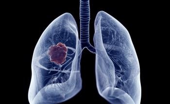 Nanoplatform Integrates Effectively with Cancer Therapies