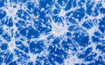 How Nanomedicines can Shape the Future of Glioblastoma Therapy