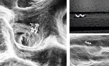 Researchers Develop Nanobots That Can Assist In Accurate Root Canal Treatments