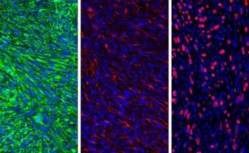 Nanoparticles Effectively Used to Delay or Prevent Relapse of Brain Cancer in Mice Models