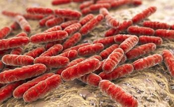 Engineering Photoluminescent Bacteria through Gold Nanoparticle Studs