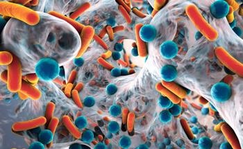Surface Wettability Found Influential in Nanopillar's Antibacterial Ability