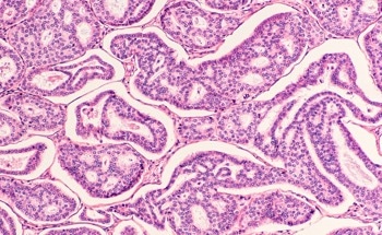 These Nanoparticles are Promising Candidates for Sustained Breast Cancer Drug Delivery