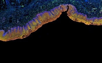 Gold Nanoshells Enhance LDI-MS Tissue Imaging
