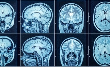 Green Nanoparticles Synthesized for CT Imaging Applications