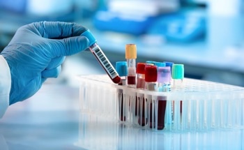 Carbon Nanotube Biosensors Help Detect Alzheimer's Disease